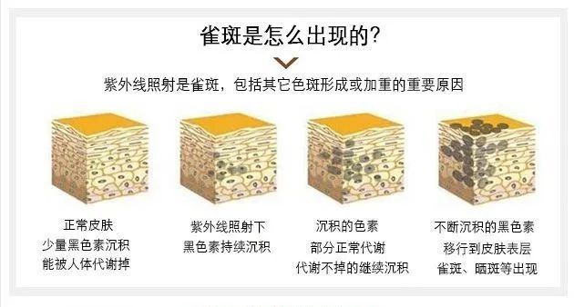 褐斑和雀斑怎么区别,有黄褐斑雀斑要如何保养才能淡化