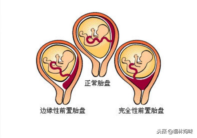 怀孕不能吃七种的食物,怀孕不能吃哪些蔬菜水果肉类