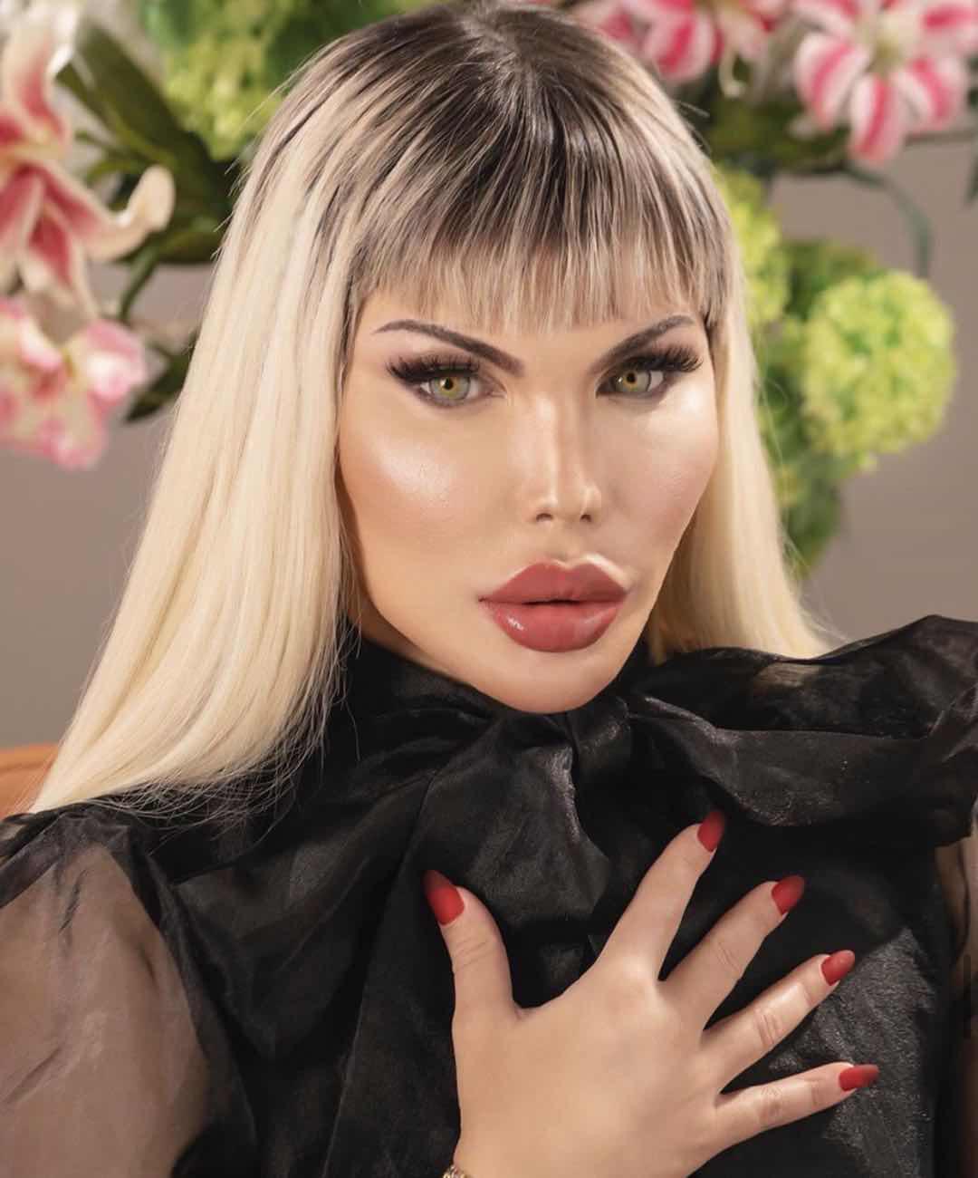 巴西男整容42次图片,巴西男模花数百万整容