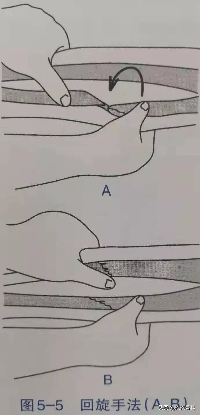 骨折手法整复术多少钱,骨折恢复手法视频教程