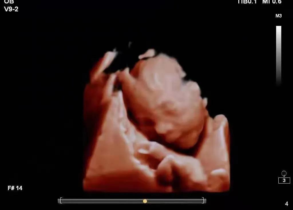 北京到深圳，34岁到43岁，千里寻医，十年期盼，终得好孕