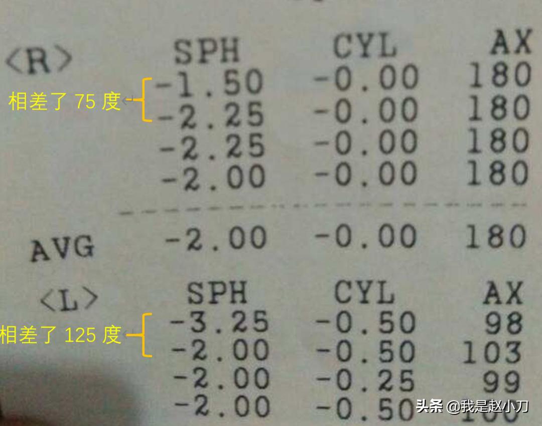 散瞳会影响裸眼视力吗,散瞳会不会对眼睛有什么影响