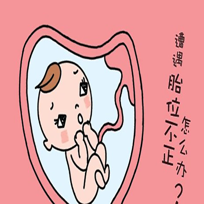 孕检说胎头偏小,胎位不正纠正操做多久才有效果