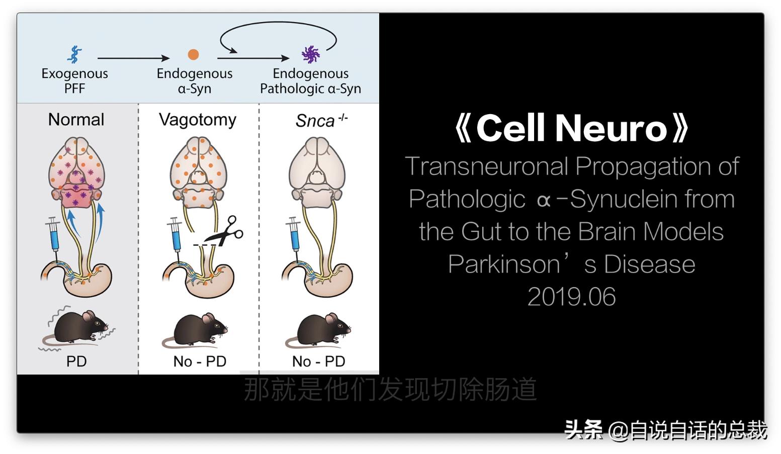吃翔救命，最奇葩的药，人体“第二大脑”的五个惊奇