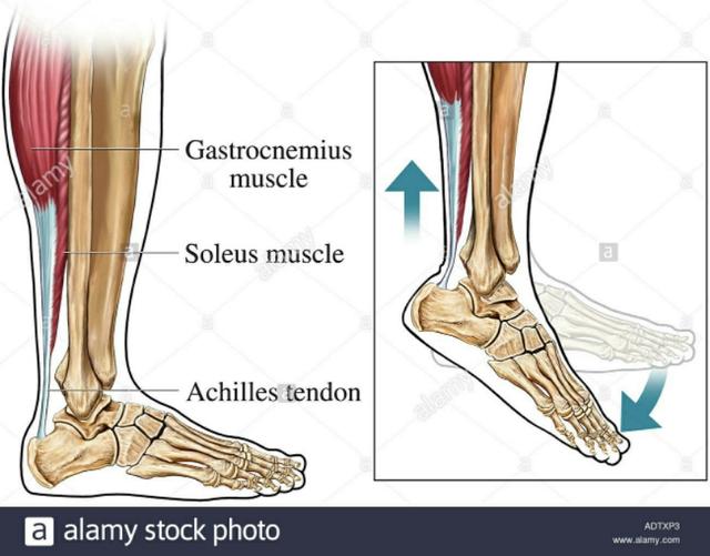 拇外翻大脚趾疼如何在家就能治,大脚拇指痛要警惕