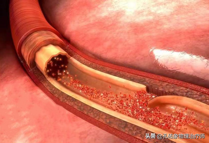 胸和肩胛骨疼痛是什么原因,右胸和后背肩胛骨疼痛是什么原因