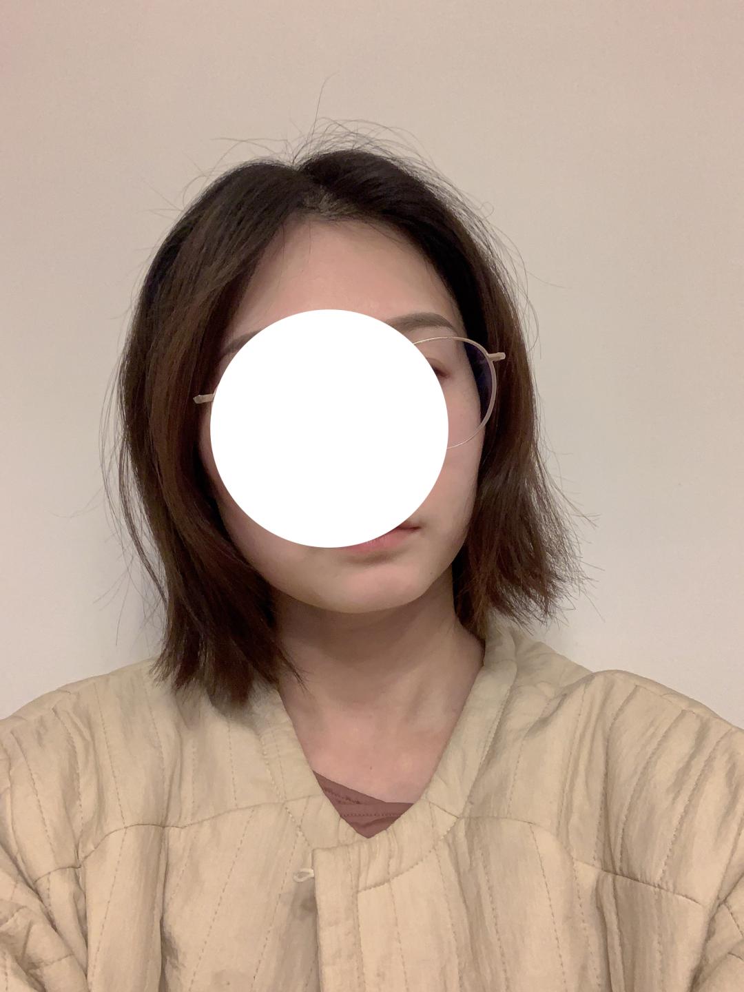 头型尖怎么整容,头型太丑什么发型能补救