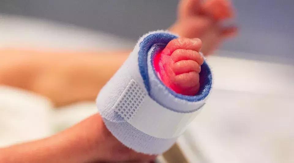 早产宝宝要吃奶的表现,早产宝宝怎么吃奶粉