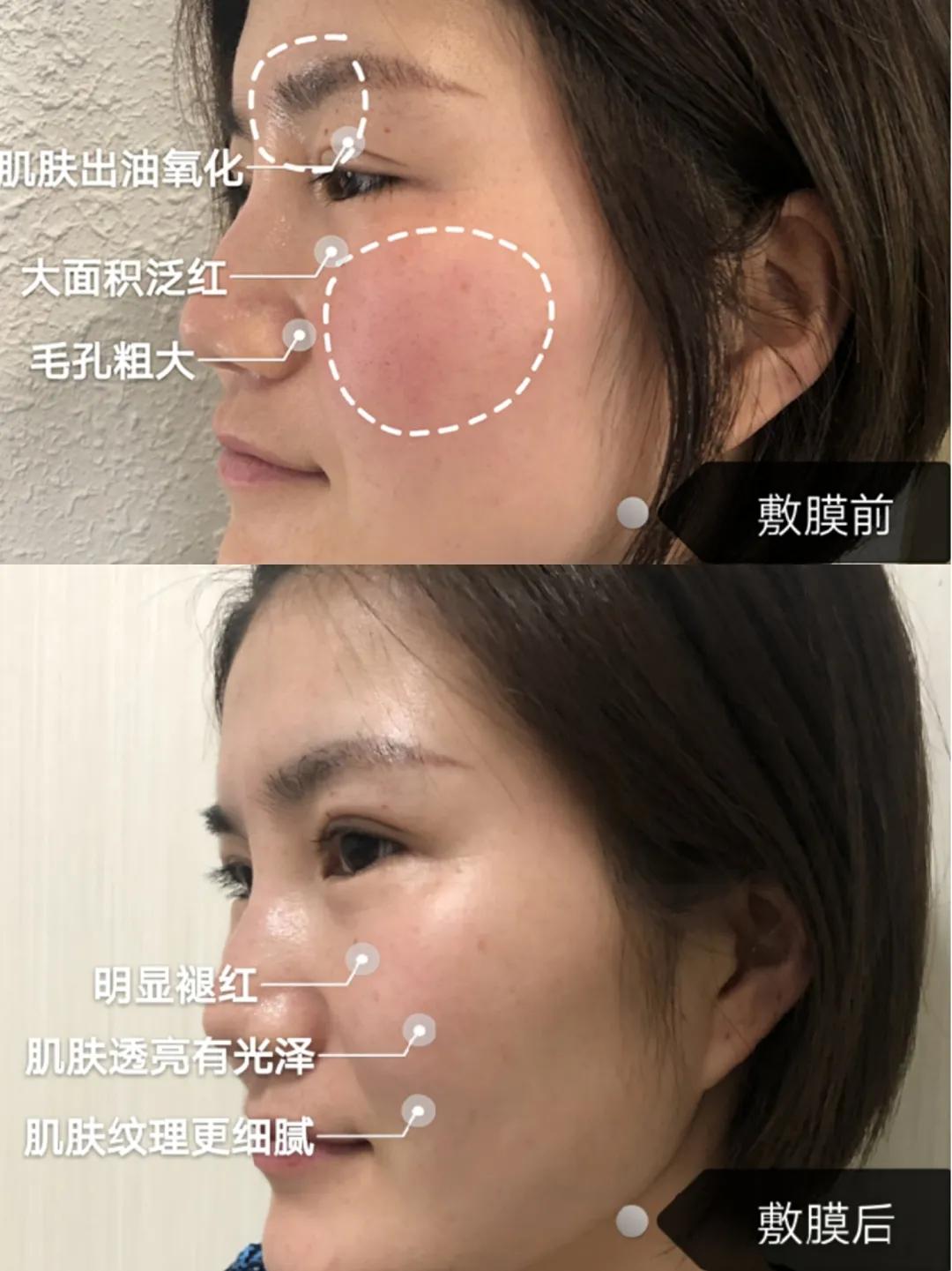 快问快答面膜篇,快问快答护肤问题