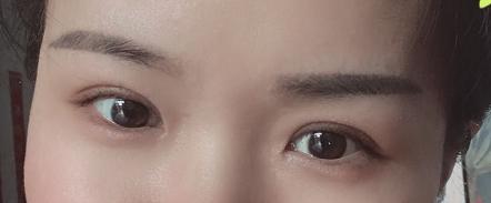 男的割双眼皮好看吗,割双眼皮好看吗动画