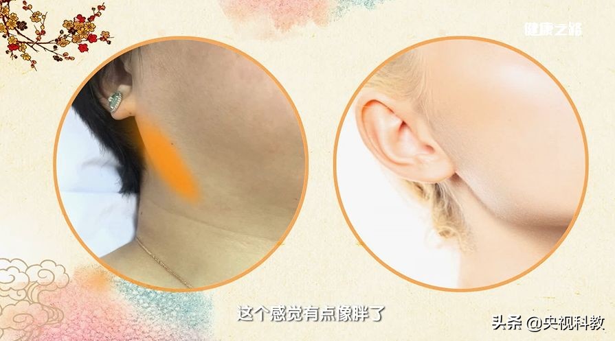 肌瘤息肉结节,囊肿结节息肉肌瘤的根本原因