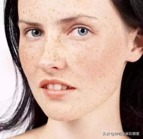 为什么用美白精华皮肤变白,为什么用了美白护肤品反而变黑了