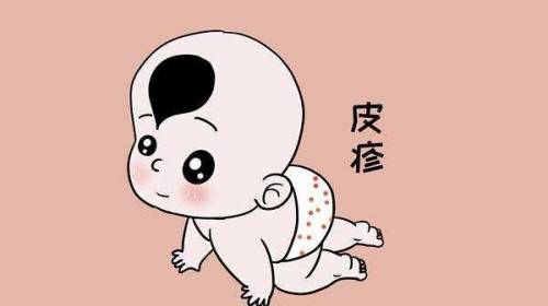 宝宝身上的痱子和热疹怎么区分,婴儿痱子和皮疹的区别
