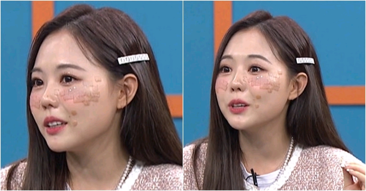 脸上贴胶布的网红,脸上粘胶带的美妆博主