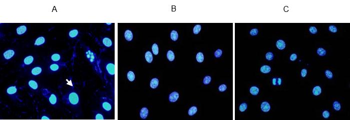 细胞培养中的污染预防措施,细胞培养过程中的支原体污染图片