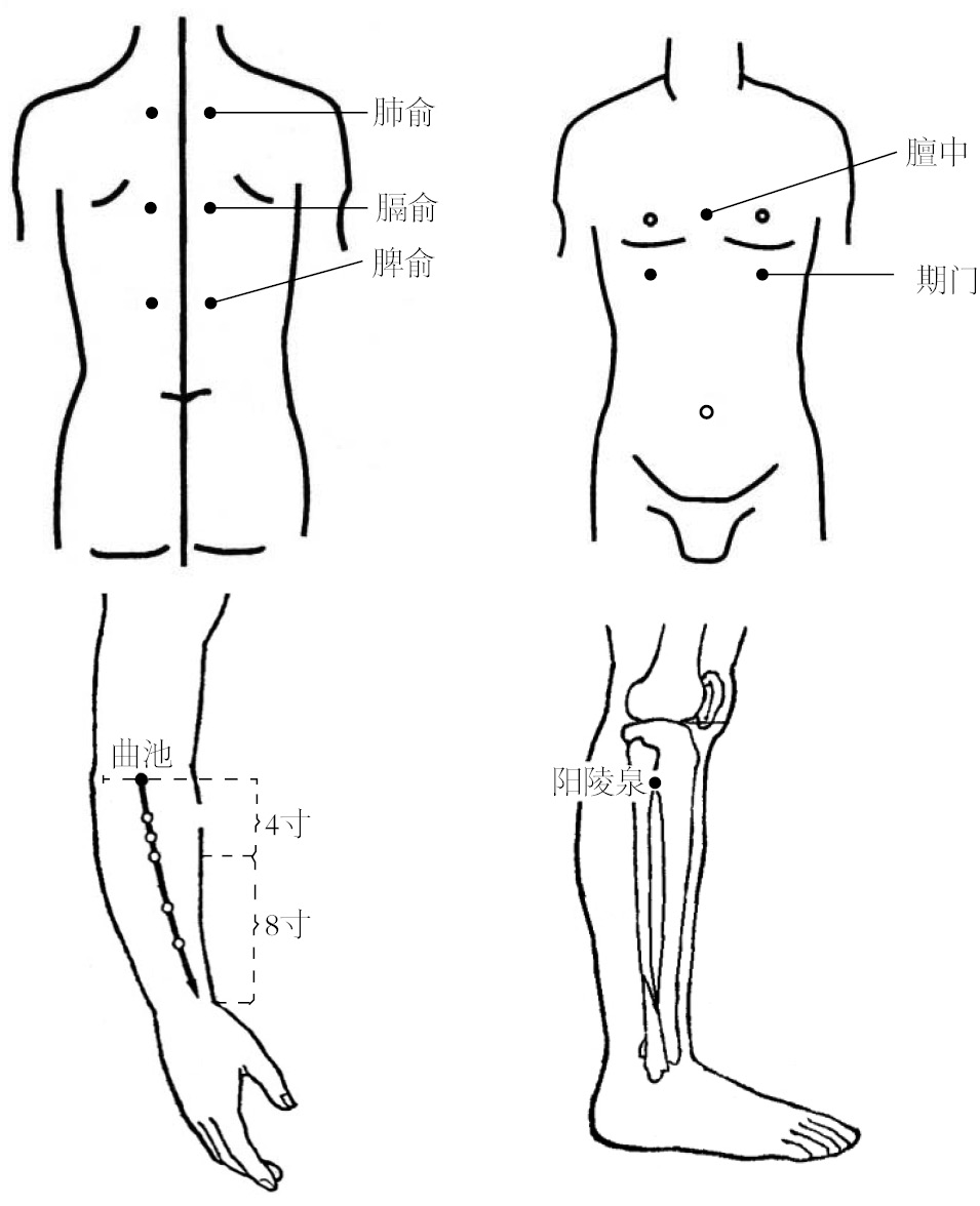 胸膜炎的位置在身体的哪个部位,胸膜炎是胸腔积液么