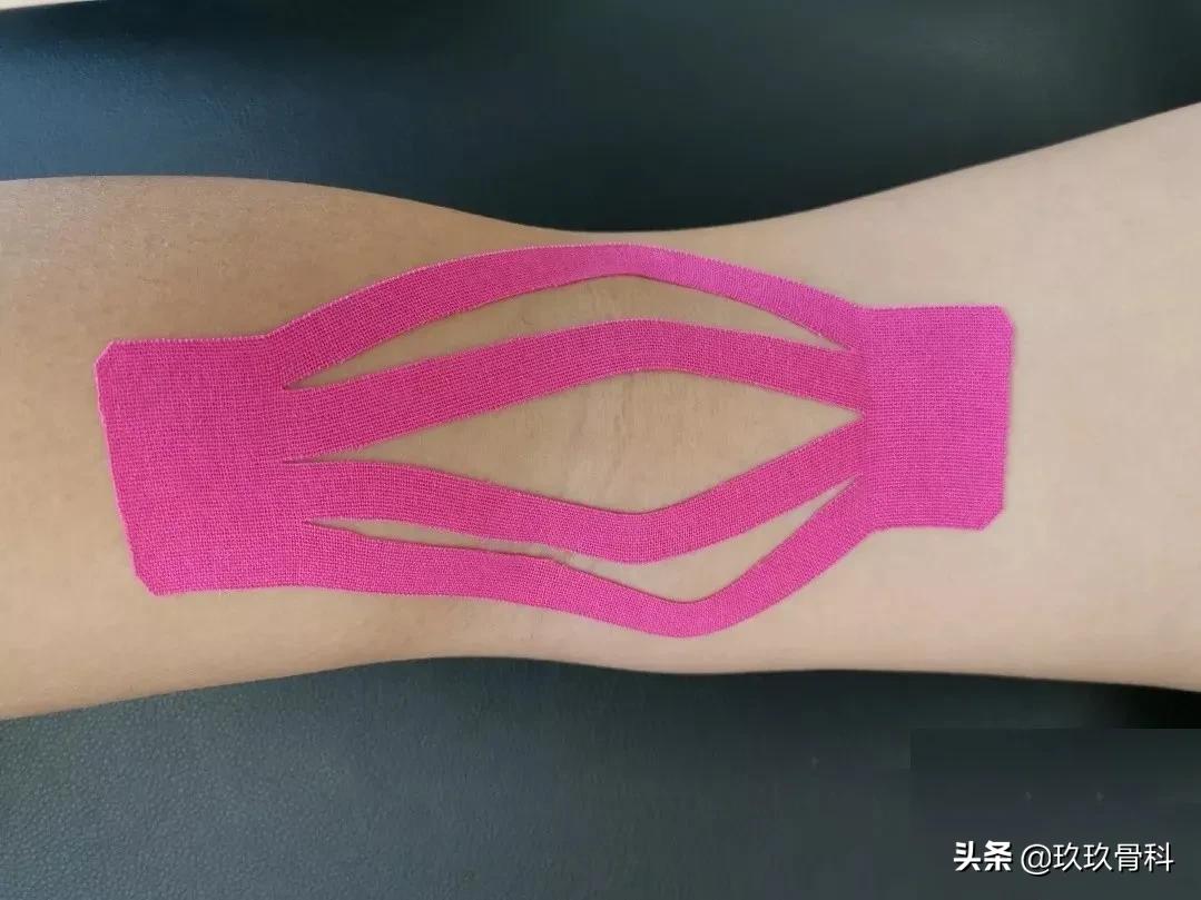 acl十字韧带重建,acl重建和十字韧带重建