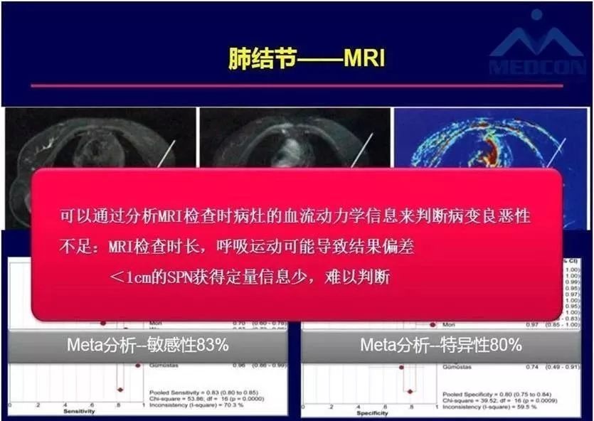 肺小结节的诊断,肺小结节的最佳治疗方法是什么