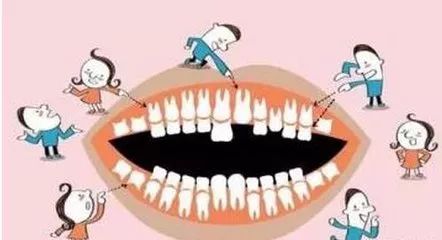 儿童双排牙是自然掉还是拔,孩子刚长了双排牙医生建议别拔