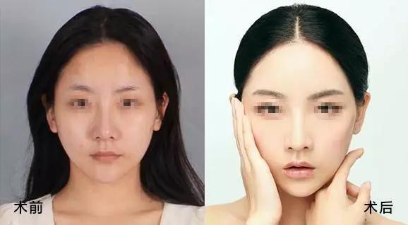 就因为这四个部位,别人像15而你像45