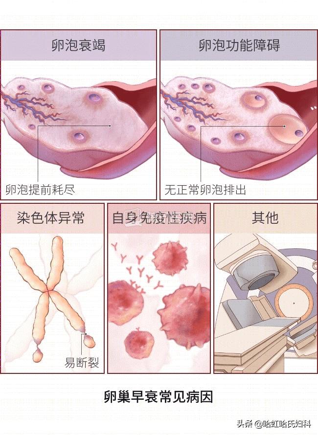 月经由7天变3天正常吗,月经由7天变成3天是什么原因