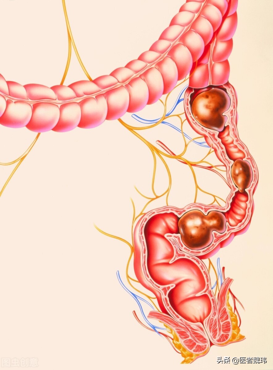 小孩便秘的危害,老年人便秘为什么不能轻视