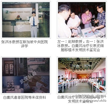 防治白癜风全面升级,武汉北大白癜风医院看白癜风