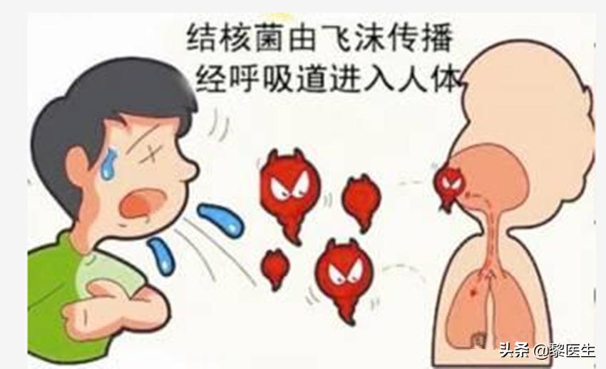 肺结核药物副作用胃疼怎么办,肺结核药物对心脏有副作用吗