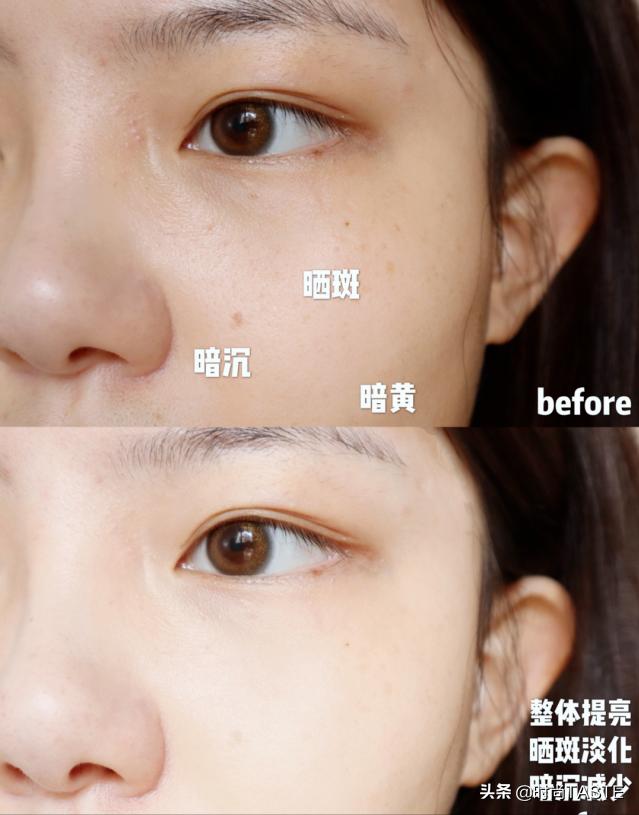 精华液跟精华水哪个能直接涂,精华液有必要涂抹吗