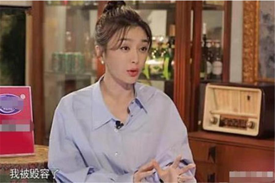 拍戏时过敏，为不影响进度和效果硬是挤掉200个痘，她太敬业了