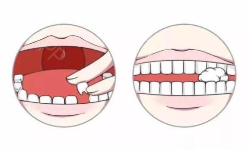 牙痛怎么缓解有妙招,牙痛怎么快速解决小妙招