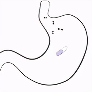 芬氟拉明口服溶液,芬氟拉明检测