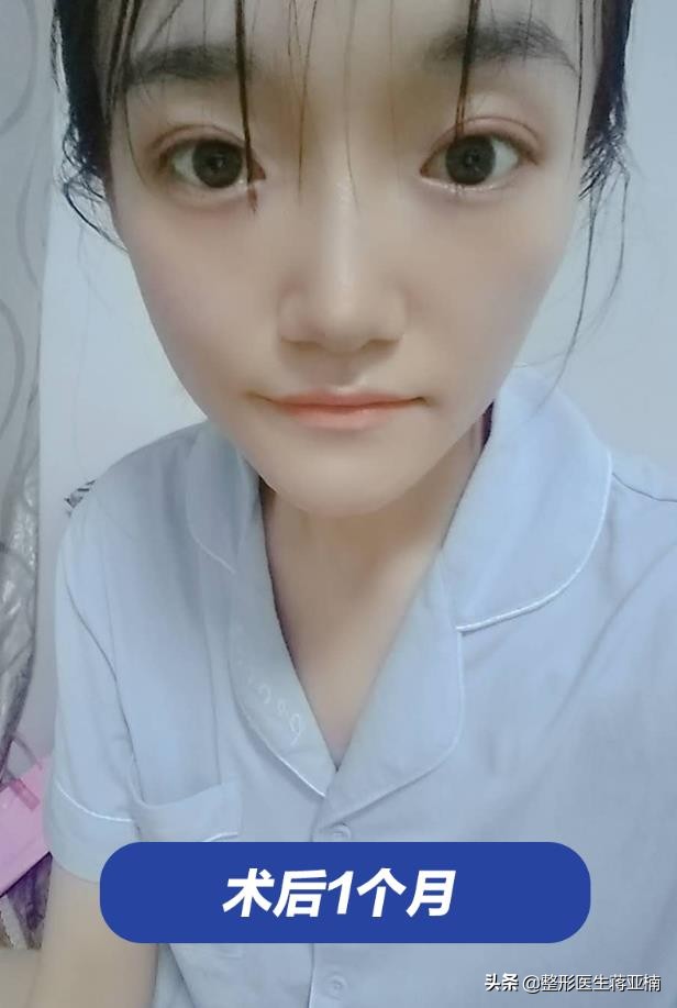 青春不留痘祛痘效果好吗,青春不长痘