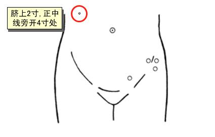 严重胃下垂艾灸几次能有效果,胃下垂艾灸有病理反应吗