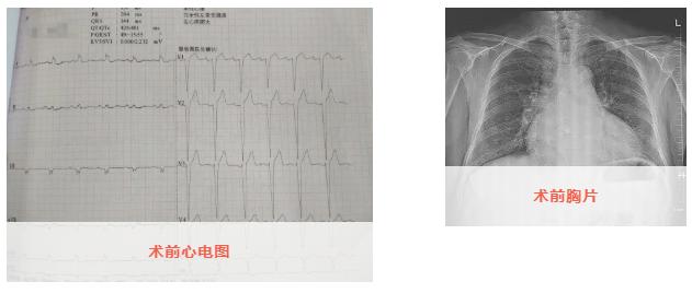 淄博市中心医院心力衰竭,淄博中心医院西院区手术