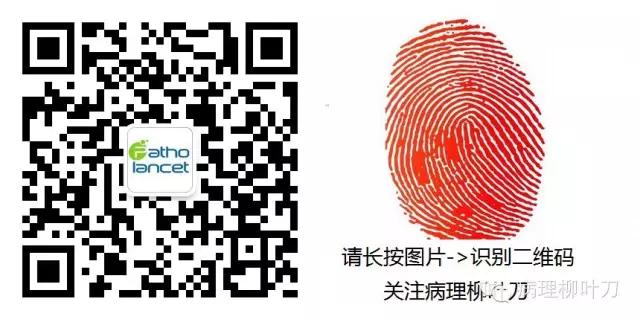 精准医疗时代,PTCLs分子生物学标志认识及其治疗进展