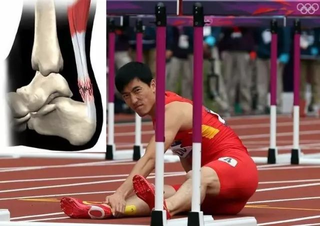 科学跑步不伤膝盖,坡道跑步伤膝盖吗