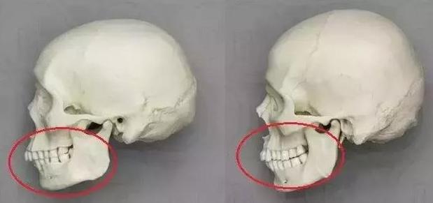 女人该如何淡化法令纹,最显老的法令纹解决方法