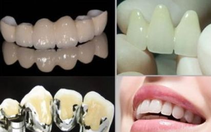 二氧化锆牙齿能做ct和核磁共振吗,氧化锆全锆牙冠能做核磁共振吗