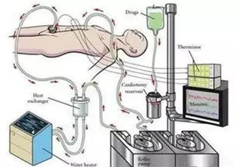 热疗43度能杀死癌细胞吗,43度恒温治疗癌症