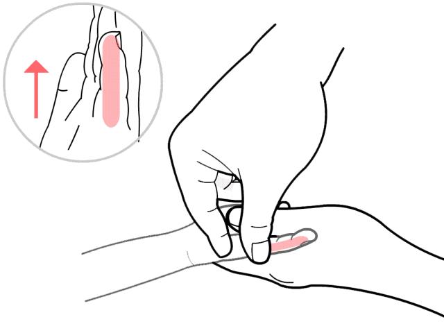 宝宝黄疸康复治疗,新生儿黄疸怎么退得快推拿手法