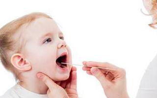 宝宝扁桃体发炎怎么预防最好,小孩扁桃体炎平时怎么预防