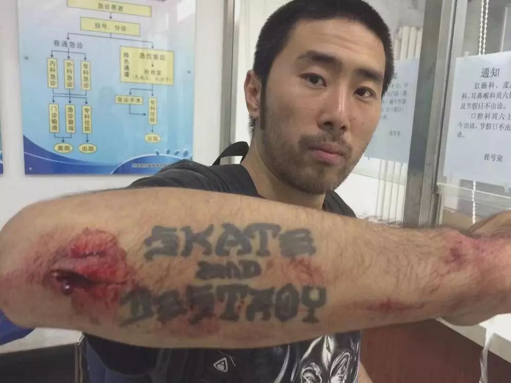 滑板人与普通人,滑板人的生活现状