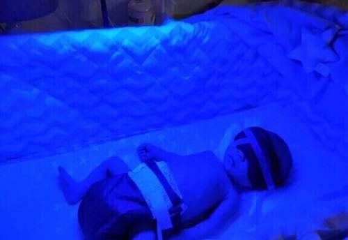 新生儿黄疸需要停母乳吃药吗,新生儿黄疸需要吃益生菌吗