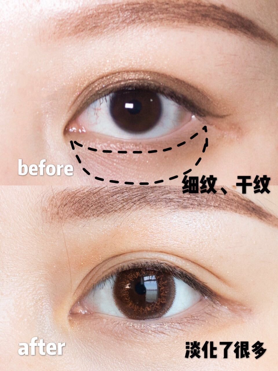 欧莱雅紫熨斗眼霜测评结果,欧莱雅紫熨斗眼霜与fancl眼霜测评