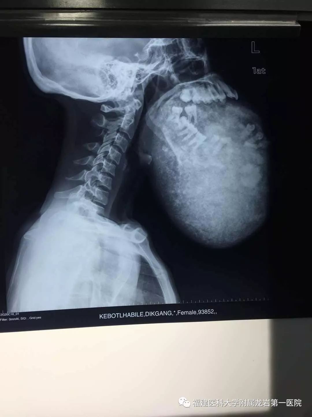 龙岩第一医院：医道*界无**，远赴非洲，让胸前的五星红旗更加闪耀