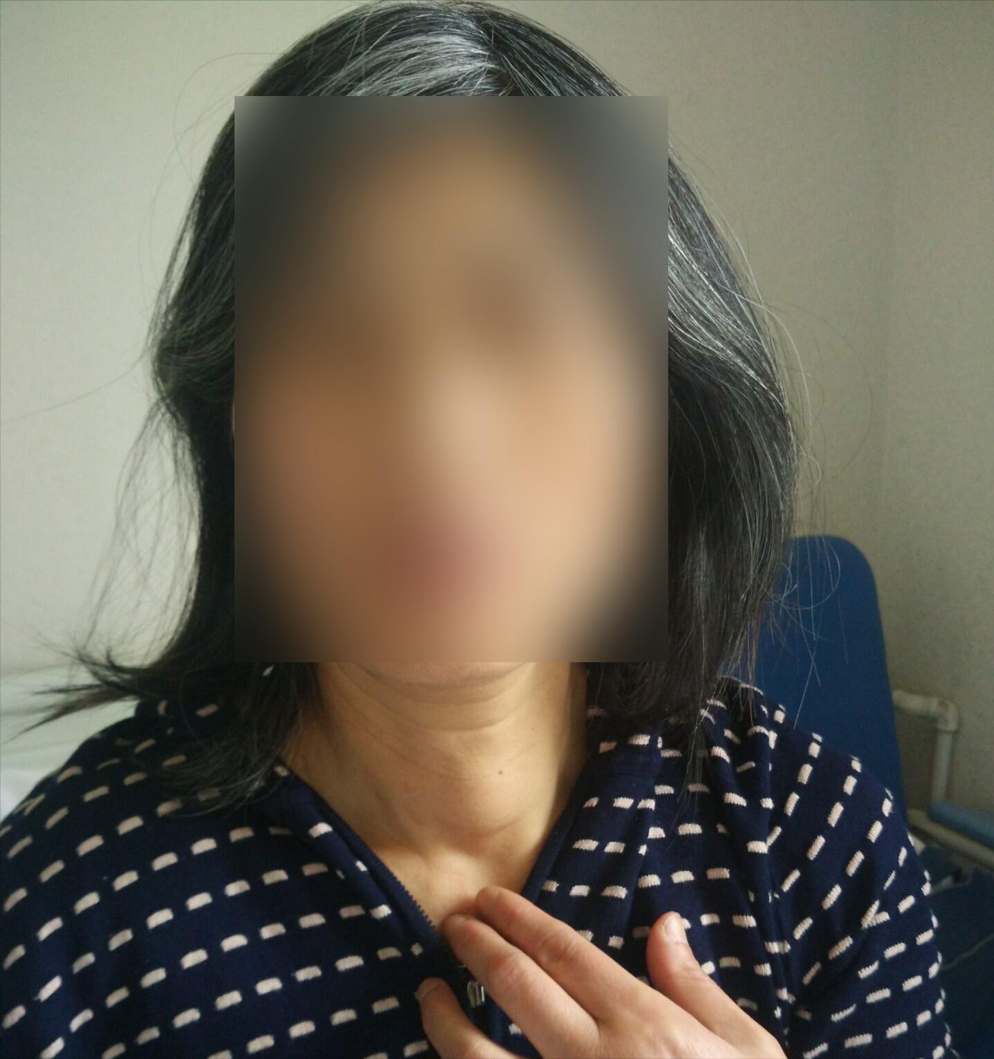 真实案例：警惕建筑材料中致病因素！患者3.9cm甲状腺结节已融合