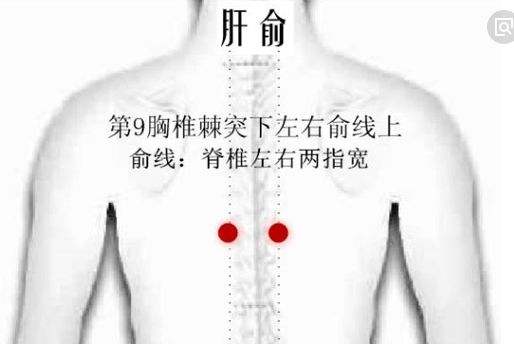因为胃酸过多导致胃痛怎么办？不要慌，不要急，用艾灸试试看