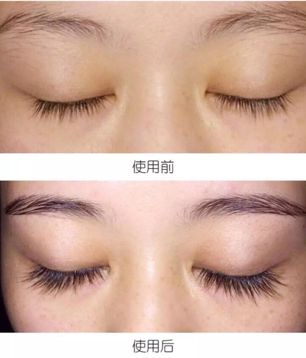 睫毛增长液真的有用吗测评,吉克隽逸睫毛增长液同款