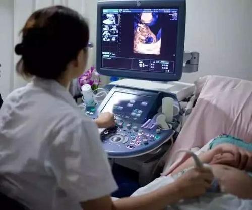 怀孕6个月发现没有胎动了,怀孕将近6个月几乎没胎动